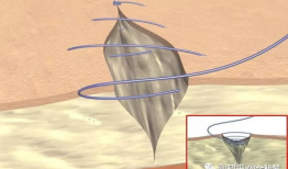 缝合视频教学,缝合技巧全解析